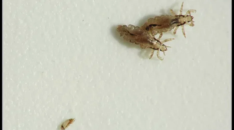 Check For Lice Weekly: Health Unit