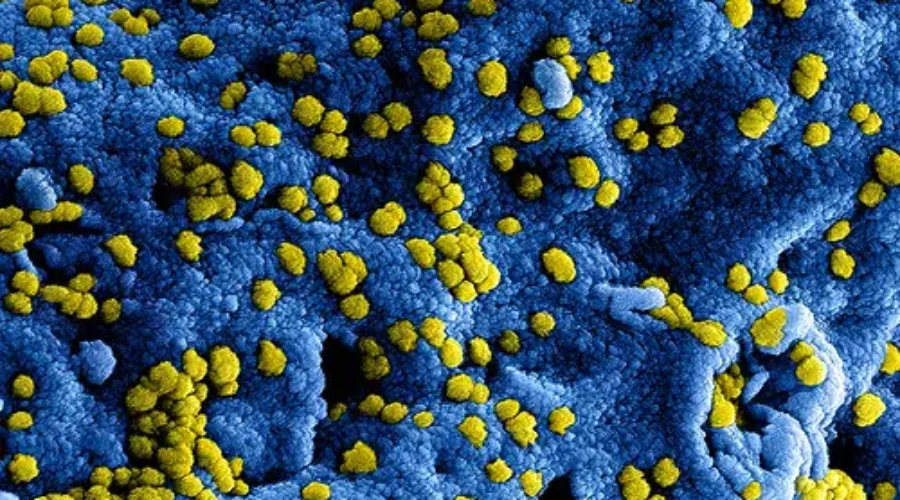 Canadian Cruise Passengers With Coronavirus Being Monitored