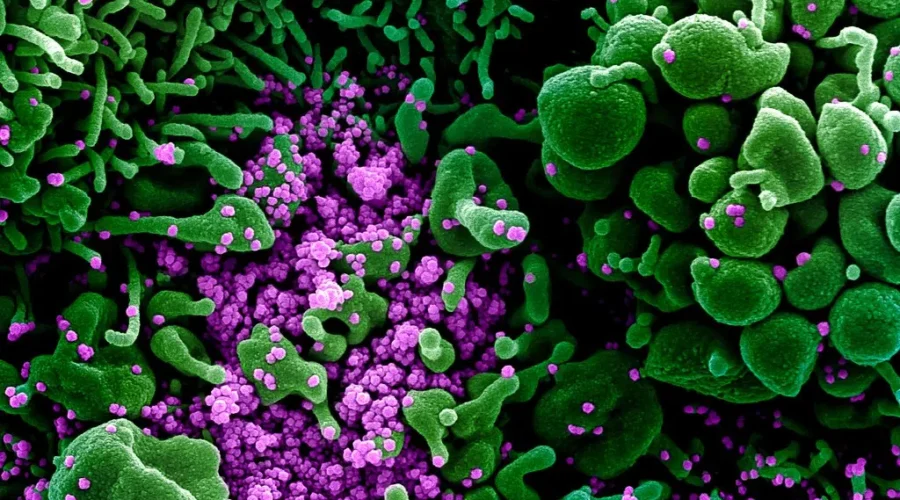Grim Times For COVID-19 Cases In Wisconsin