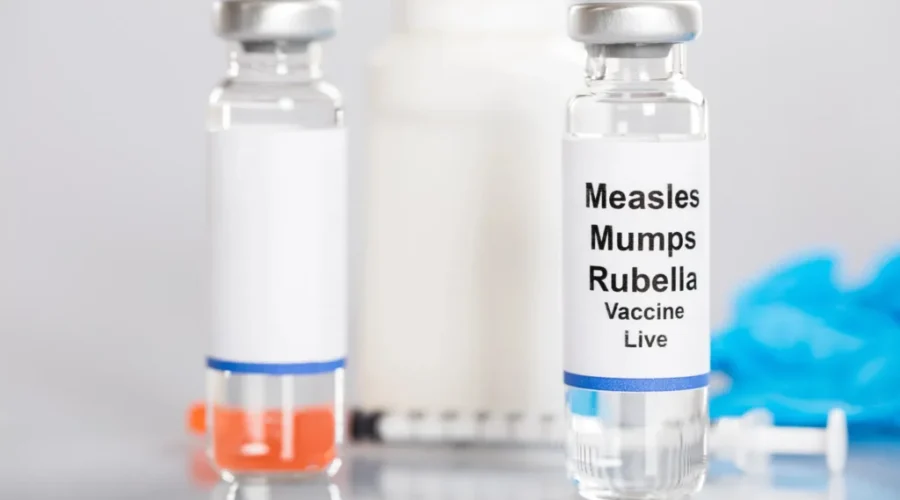 Measles advisory issued in northwestern Ontario