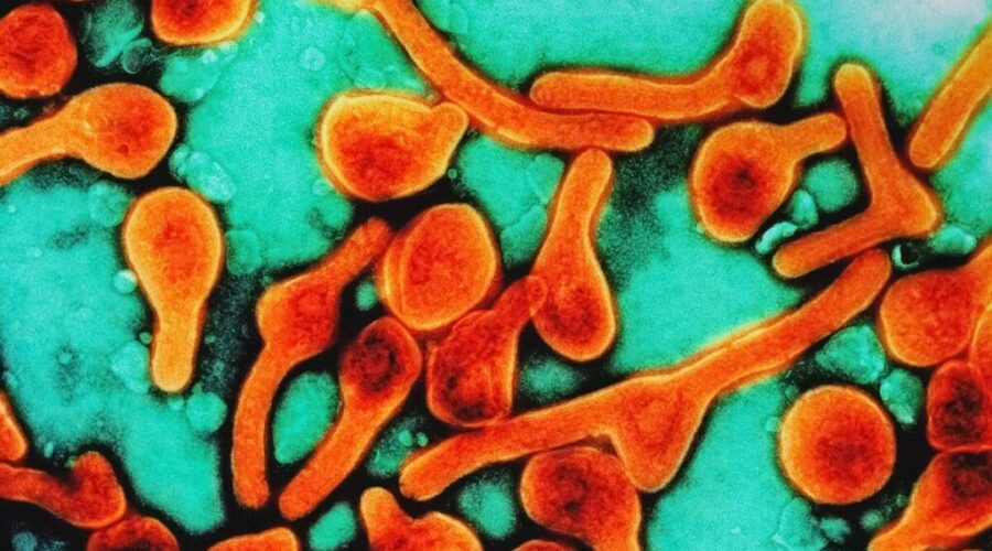Syphilis rates in Thunder Bay nearly double provincial average
