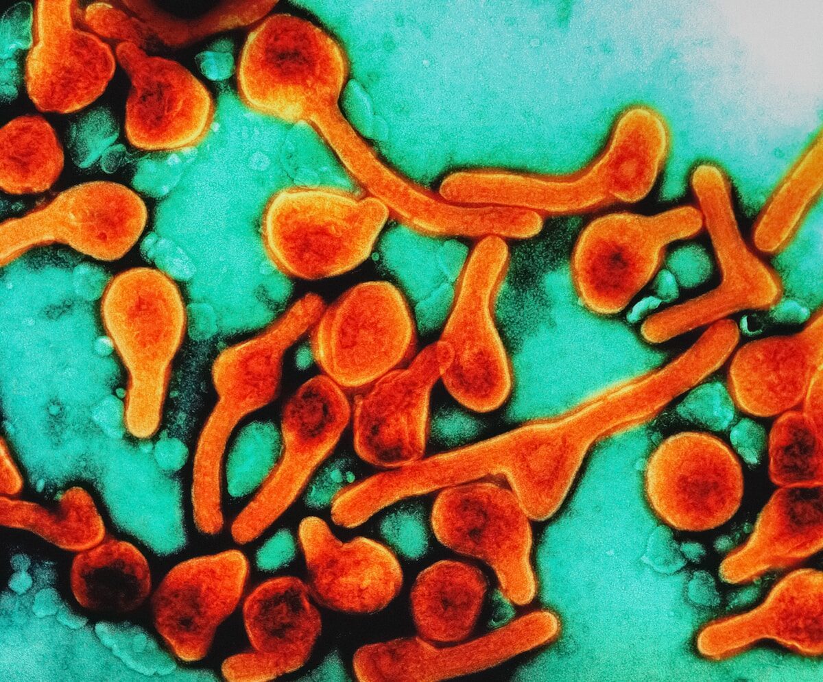 a close up of an animal's blood cells